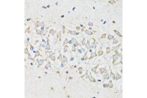 Immunohistochemistry (Paraffin-embedded Sections) (IHC (p)) image for anti-NUDC (AA 1-331) antibody (ABIN6144924)