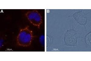 Expression of KCNK18 in ND7/23 cell line - Cell surface detection of KCNK18 in living mouse/rat neuroblastoma x dorsal root ganglion neuron hybrid cell line (ND7/23). (KCNK18 抗体  (Extracellular))