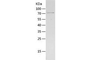 Western Blotting (WB) image for GDP Dissociation Inhibitor 2 (GDI2) (AA 1-445) protein (His-IF2DI Tag) (ABIN7286353) (GDI2 Protein (AA 1-445) (His-IF2DI Tag))