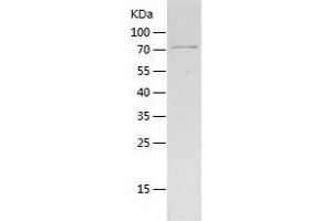 GDI2 Protein (AA 1-445) (His-IF2DI Tag)