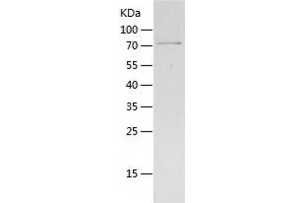 GDI2 Protein (AA 1-445) (His-IF2DI Tag)