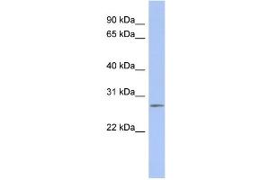 WB Suggested Anti-C14orf166 Antibody Titration:  0. (C14orf166 抗体  (Middle Region))