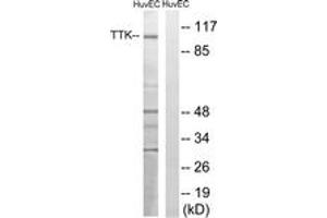 Western blot analysis of extracts from HuvEc cells, treated with etoposide 25uM 24H, using TTK (Ab-676) Antibody. (Mps1 抗体  (AA 642-691))