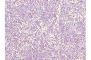 Immunohistochemistry (IHC) image for anti-Zinc Finger, DHHC-Type Containing 16 (ZDHHC16) (AA 288-377) antibody (ABIN7162540)