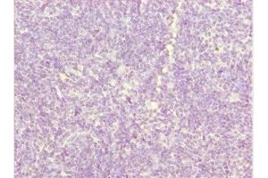 Immunohistochemistry of paraffin-embedded human thymus tissue using ABIN7162540 at dilution of 1:100 (ZDHHC16 抗体  (AA 288-377))