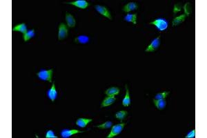 Immunofluorescent analysis of Hela cells using ABIN7148328 at dilution of 1:100 and Alexa Fluor 488-congugated AffiniPure Goat Anti-Rabbit IgG(H+L) (C1QTNF9B 抗体  (AA 2-192))