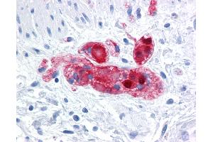 Immunohistochemistry (IHC) image for anti-Secretagogin, EF-Hand Calcium Binding Protein (SCGN) (AA 1-277) antibody (ABIN574421)