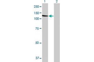 Western Blot analysis of SLC4A1 expression in transfected 293T cell line by SLC4A1 MaxPab polyclonal antibody. (Band 3/AE1 抗体  (AA 1-911))