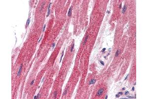 Testis (SLUG 抗体  (Middle Region))