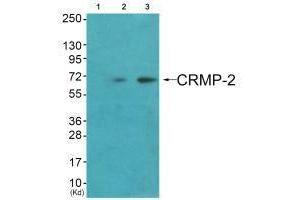 Western blot analysis of extracts from HuvEc cells (Lane 2) and JK cells (Lane 3), using CRMP-2 (Ab-522) antiobdy. (DPYSL2 抗体  (C-Term))
