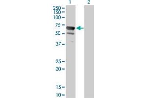 Western Blot analysis of NT5C2 expression in transfected 293T cell line by NT5C2 monoclonal antibody (M02), clone 3C1.
