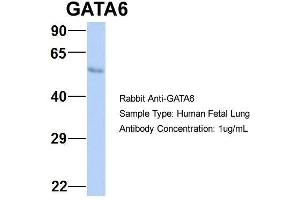 Host:  Rabbit  Target Name:  GATA6  Sample Type:  Human Fetal Lung  Antibody Dilution:  1. (GATA6 抗体  (N-Term))