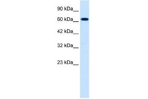 WB Suggested Anti-SCNN1B Antibody Titration:  0. (SCNN1B 抗体  (C-Term))