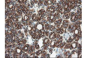 Image no. 3 for anti-Ubiquitin Specific Peptidase 9, X-Linked (USP9X) (AA 2246-2570) antibody (ABIN1491228)