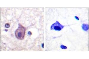 Immunohistochemistry analysis of paraffin-embedded human brain, using CD4 (Phospho-Ser433) Antibody. (CD4 抗体  (pSer433))