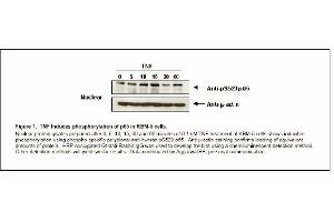 Image no. 1 for anti-Nuclear Factor-kB p65 (NFkBP65) (pSer529) antibody (ABIN116929) (NF-kB p65 抗体  (pSer529))