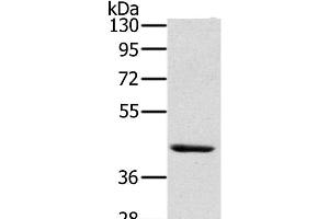 Western Blot analysis of Skov3 cell using HSD3B7 Polyclonal Antibody at dilution of 1:400 (HSD3B7 抗体)