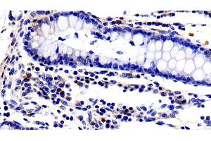 Detection of IL2Ra in Porcine Colon Tissue using Polyclonal Antibody to Interleukin 2 Receptor Alpha (IL2Ra) (CD25 抗体  (AA 22-245))