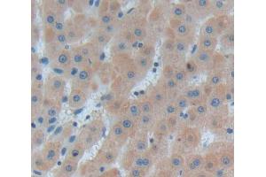 Used in DAB staining on fromalin fixed paraffin- embedded Kidney tissue (LMAN1 抗体  (AA 198-475))