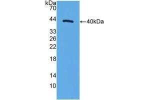 Detection of Recombinant MRP1, Human using Polyclonal Antibody to Motility Related Protein (MRP1) (CD9 抗体  (AA 112-195))