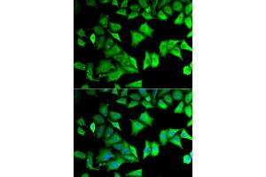 Immunofluorescence analysis of MCF-7 cells using RPS12 antibody (ABIN5973491). (RPS12 抗体)
