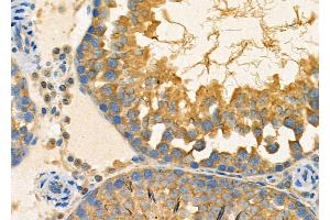 ABIN6263383 and ABIN6267002 at 1/100 staining Rat testis tissue by IHC-P. (MRRF 抗体  (Internal Region))