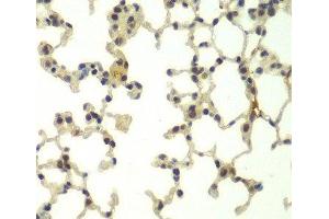 Immunohistochemistry of paraffin-embedded Mouse lung using FBXW11 Polyclonal Antibody at dilution of 1:100 (40x lens). (FBXW11 抗体)