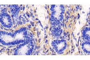 Immunohistochemistry (IHC) image for anti-Collagen, Type I, alpha 1 (COL1A1) (AA 253-471) antibody (ABIN7428014)