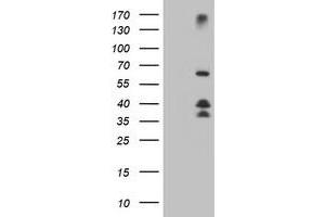 Western Blotting (WB) image for anti-Dystrobrevin, beta (DTNB) antibody (ABIN1497917) (Dystrobrevin beta 抗体)