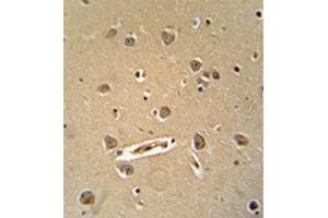 Formalin fixed, paraffin embedded human brain tissue stained with MGC24039 Antibody (C-term)  followed by peroxidase conjugation of the secondary antibody and DAB staining. (MGC24039 (AA 1073-1102), (C-Term) 抗体)