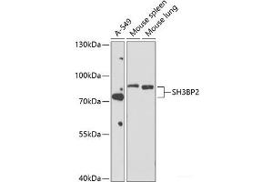 Western blot analysis of extracts of various cell lines using SH3BP2 Polyclonal Antibody at dilution of 1:1000. (SH3BP2 抗体)