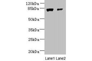 Western blot All lanes: WDR49 antibody at 7 μg/mL Lane 1: A549 whole cell lysate Lane 2: Hela whole cell lysate Secondary Goat polyclonal to rabbit IgG at 1/10000 dilution Predicted band size: 80, 60 kDa Observed band size: 80 kDa (WDR49 抗体  (AA 251-500))