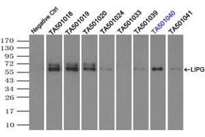 Image no. 2 for anti-Lipase, Endothelial (LIPG) antibody (ABIN1499162) (LIPG 抗体)