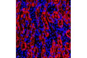 Immunofluorescence (Paraffin-embedded Sections) (IF (p)) image for anti-Signal Recognition Particle 14kDa (Homologous Alu RNA Binding Protein) (SRP14) antibody (ABIN7075596)
