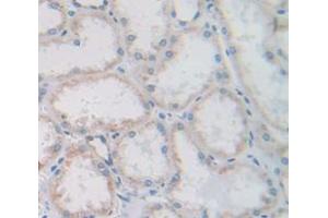 IHC-P analysis of Human Tissue, with DAB staining. (CUBN 抗体  (AA 3157-3274))