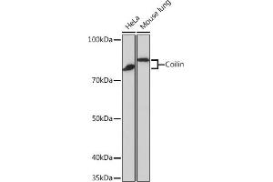 Western blot analysis of extracts of various cell lines, using Coilin Rabbit mAb (ABIN7266451) at 1:1000 dilution. (Coilin 抗体)