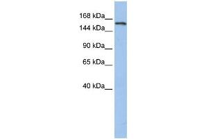 WB Suggested Anti-UBE3A  Antibody Titration: 0. (ube3a 抗体  (N-Term))