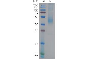 SDS-PAGE (SDS) image for GDNF Family Receptor alpha Like (GFRAL) (AA 19-351) protein (His tag) (ABIN7092777)