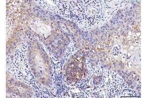 IHC analysis of Poliovirus Receptor/PVR using anti-Poliovirus Receptor/PVR antibody (ABIN7601071).