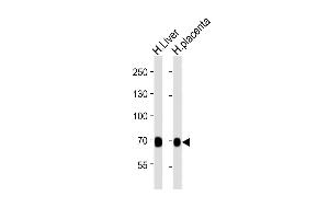 All lanes : Anti-FLT1 Antibody at 1:2000 dilution Lane 1: human Liver lysates Lane 2: human placenta lysates Lysates/proteins at 20 μg per lane. (FLT1 抗体  (AA 1-380))