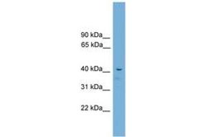 Image no. 1 for anti-Adrenocortical Dysplasia Homolog (ACD) (C-Term) antibody (ABIN6744514) (ACD 抗体  (C-Term))
