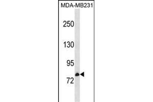 CNNM3 Antibody (Center) (ABIN1881217 and ABIN2838599) western blot analysis in MDA-M cell line lysates (35 μg/lane). (Cyclin M3 抗体  (AA 431-457))