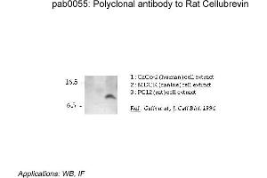 Image no. 1 for anti-Vesicle-Associated Membrane Protein 3 (VAMP3) (N-Term) antibody (ABIN347007) (VAMP3 抗体  (N-Term))