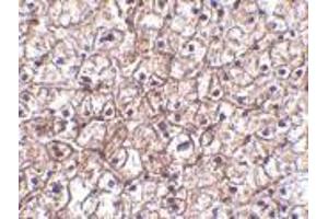 Immunohistochemistry of IFN-b in human liver tissue with IFN-b antibody at 5 μg/ml. (IFNB1 抗体  (Center))