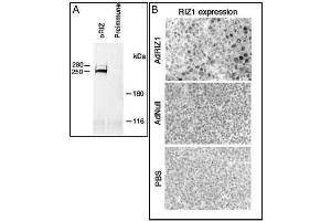 A) Rat B50 brain tumor cell extracts were immunoprecipitated with RIZ1 antibody (cat (ABIN388010 and ABIN2845353)) or preimmune (ref. (PRDM2 抗体  (AA 245-573))