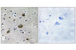 Immunohistochemistry (IHC) image for anti-A Kinase (PRKA) Anchor Protein 1 (AKAP1) (Internal Region) antibody (ABIN1849848) (AKAP1 抗体  (Internal Region))