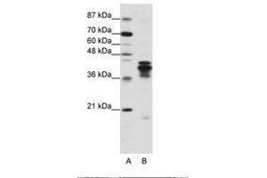 Image no. 2 for anti-Heterogeneous Nuclear Ribonucleoprotein D (HNRNPD) (C-Term) antibody (ABIN203266) (HNRNPD/AUF1 抗体  (C-Term))
