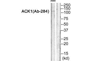 Western Blotting (WB) image for anti-tyrosine Kinase, Non-Receptor, 2 (TNK2) (Tyr284) antibody (ABIN1847978) (TNK2 抗体  (Tyr284))