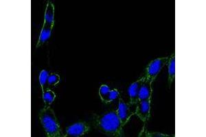 Immunofluorescence analysis of B16 cells using FAK mouse mAb (green). (FAK 抗体)