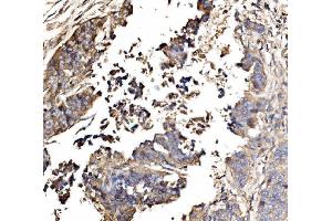 IHC analysis of GNAL using anti-GNAL antibody (ABIN7599757).